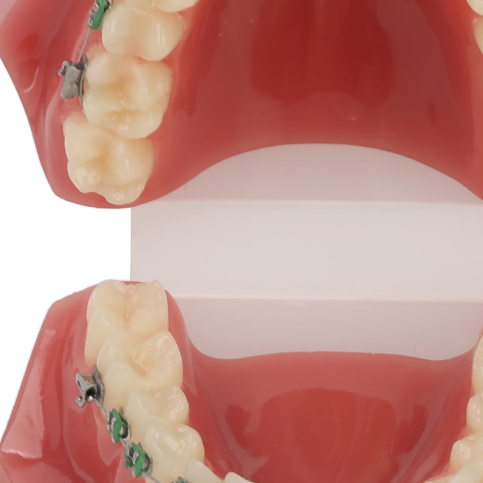 Modelo de Ortodoncia Profesional con Brackets Cerámicos y Metálicos para Enseñanza Odontológica