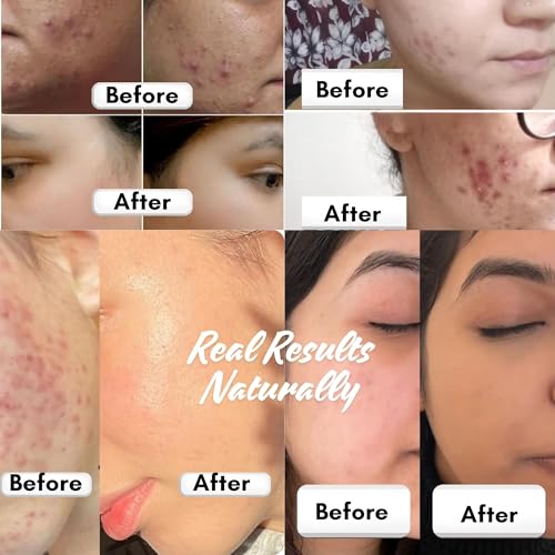Image of Organic Facial Kit - Natural Face Wash & Rose Water Toner Set for Glowing Skin, Hydrating & Cleansing, Suitable for All Skin Types, Paraben-Free, Cruelty-Free Skincare