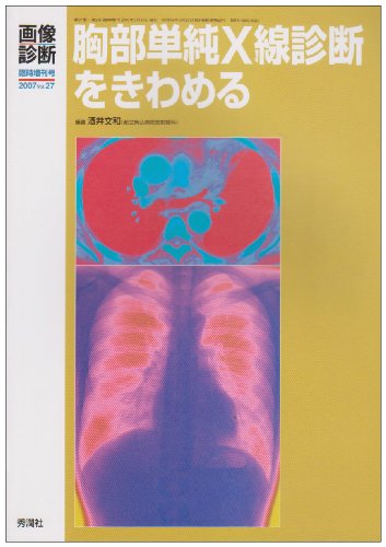 無料電子書籍 アプリ 胸部単純X線診断をきわめる (画像診断 07年臨時増刊号) バイ