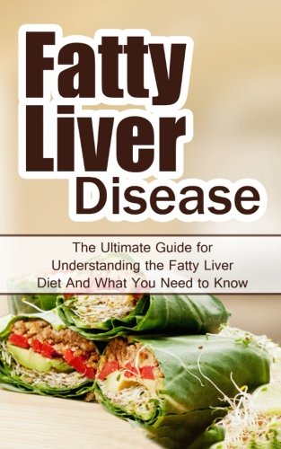 Fatty Liver Disease: The Ultimate Guide for Understanding the Fatty Liver Diet And What You Need to Know (FLD, Alcohol, NAFLD, Metabolic Syndrome, Steatosis, Alcoholic Liver Disease, Obesity)