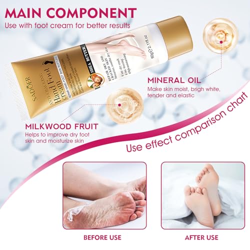 Silikon Socken für Creme,4 Stück Feuchtigkeitsspendende Socken+60g Fußcreme,Hornhaut Silikon Socken,Hornhautentferner Socken,Fußmaske Socken,Pflege für Rissige und Raue Haut,Hautfarbe+Rosa