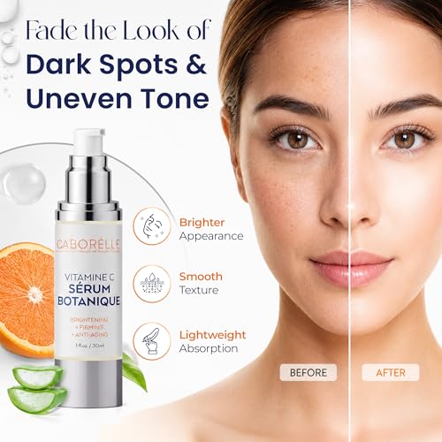 Image of Vitamin C Serum for Face with Vitamin E & Ferulic Acid - Dark Spot Corrector & Brightening Serum with Plant Stem Cell Extract & Hyaluronic Acid, Gentle for Sensitive Skin (1 fl oz)