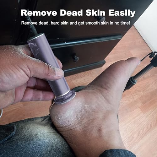 I·B·N G IBNG20231115US Electric Callus Remover For Feet thumb #3