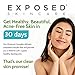 Exposed Skin Care, Moisture Complex Oil-Free Daily Face Moisturizer For Women and Men – Non-Comedogenic Lightweight Hydrating Gel with Green Tea, Pumpkin Seed and Caffeine for Oily, Acne-Prone Skin