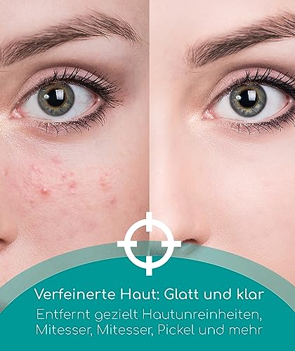 Komedonenquetscher Medi Grade Mitesserentferner Set 7-teilig