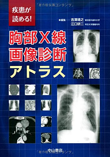 疾患が読める! 胸部X線画像診断アトラス | 吉澤靖之, 江口研二 |本
