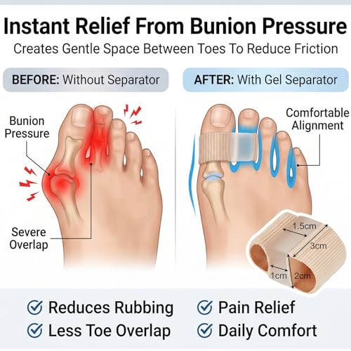 Image of Gel Toe Separators for Bunions(1PCS) - Breathable Fabric Toe Spacers with Gel Lining for Bunion Pain Relief & Hammer Toe Correction - Design for Men & Women (Size S, 1 Pcs)