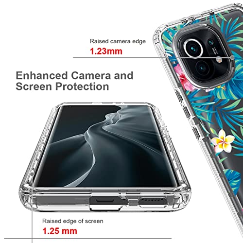 Coque Xiaomi 11 5G antichoc intégrale évitant les bris d'écran - 2