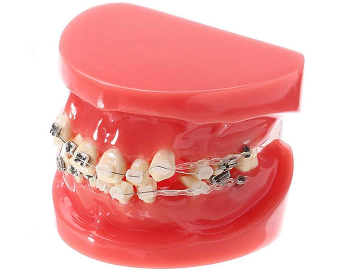 Sjdopulse Anatomy Teeth Model - Education Teeth Model Child Teeth Teaching Model - Adult Standard Orthodontic Oral Tooth Demonstration Model - For Educational Oral Teeth Training Model