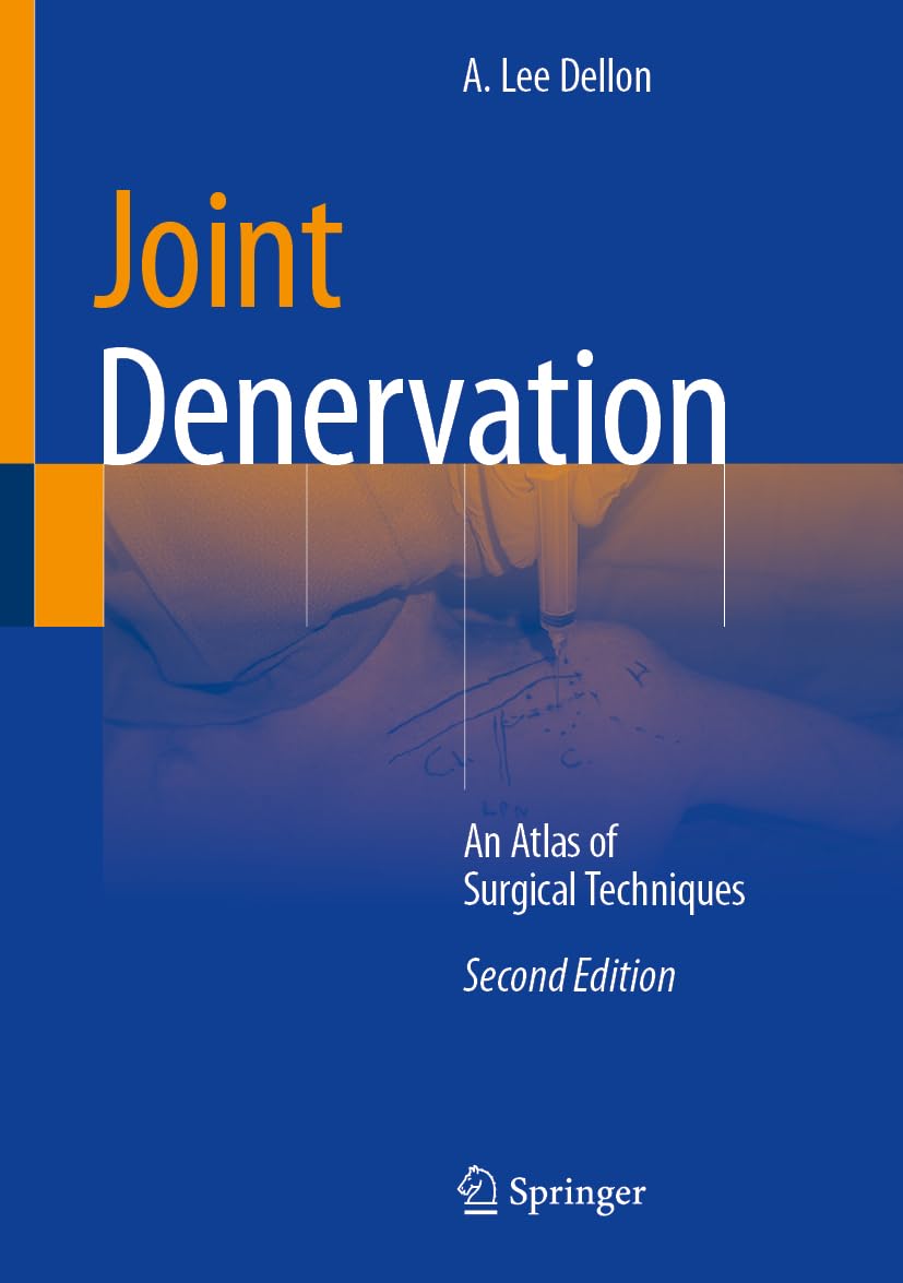 Joint Denervation: An Atlas of Surgical Techniques