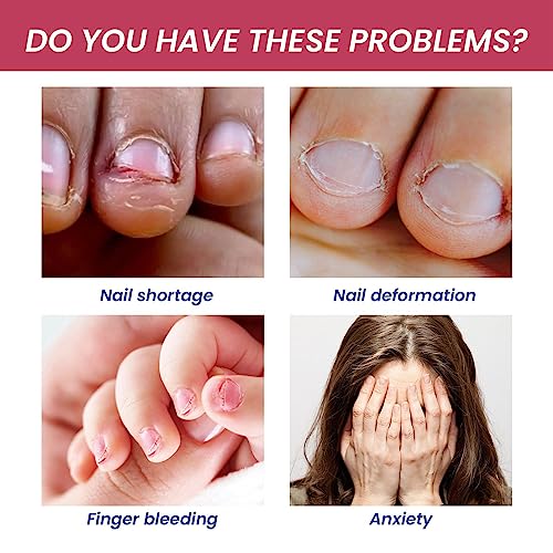No Bite Nail Polish, Nail Biting Treatment with Stop Nail Repair Formula, Anti Nail Biting Nail Polish Clear Nail Varnish, Discourages Nail Biting and Thumb Sucking, Safe Natural Plant Extract (1) - Image 3