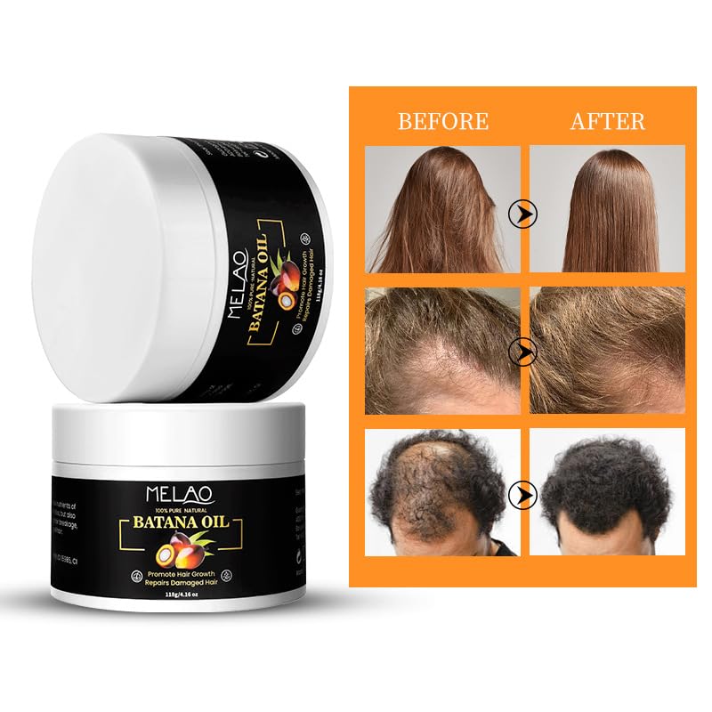 Miniatura 3 de Aceite de batana puro 100% natural para el crecimiento del cabello, mejora el grosor del cabello, evita la pérdida de cabello, repara el cabello