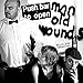 Push Barman To Open Old Wounds