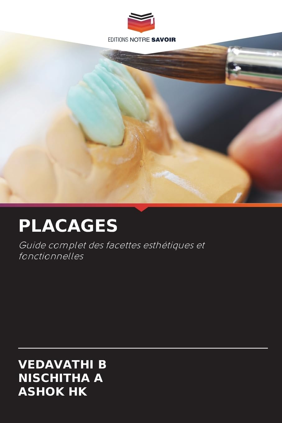 PLACAGES: Guide complet des facettes esthétiques et fonctionnelles