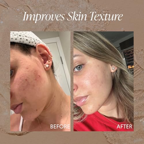 Image of Exfoliating Face Gel W /Jojoba Oil, Salicylic Acid, Glycolic Acid & More | For Dead Skin, Unclog Pores, Remove Dead Skin, Smooth Skin Bumps Co (Exfoliant)