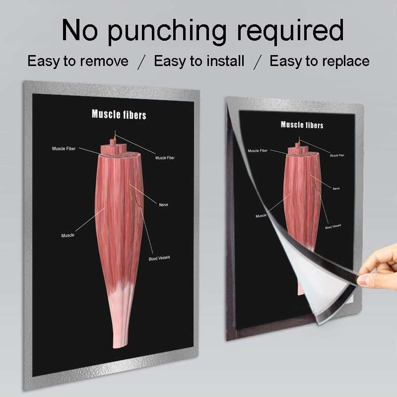 Image of Taanfu Body Educational Learning Anatomy Posters ，Muscle Fiber Art Muscle Villi Anatomy Art Poster Digestive System Organs Illustration Small Intestine Physiology Anatomy Wall Art Villi