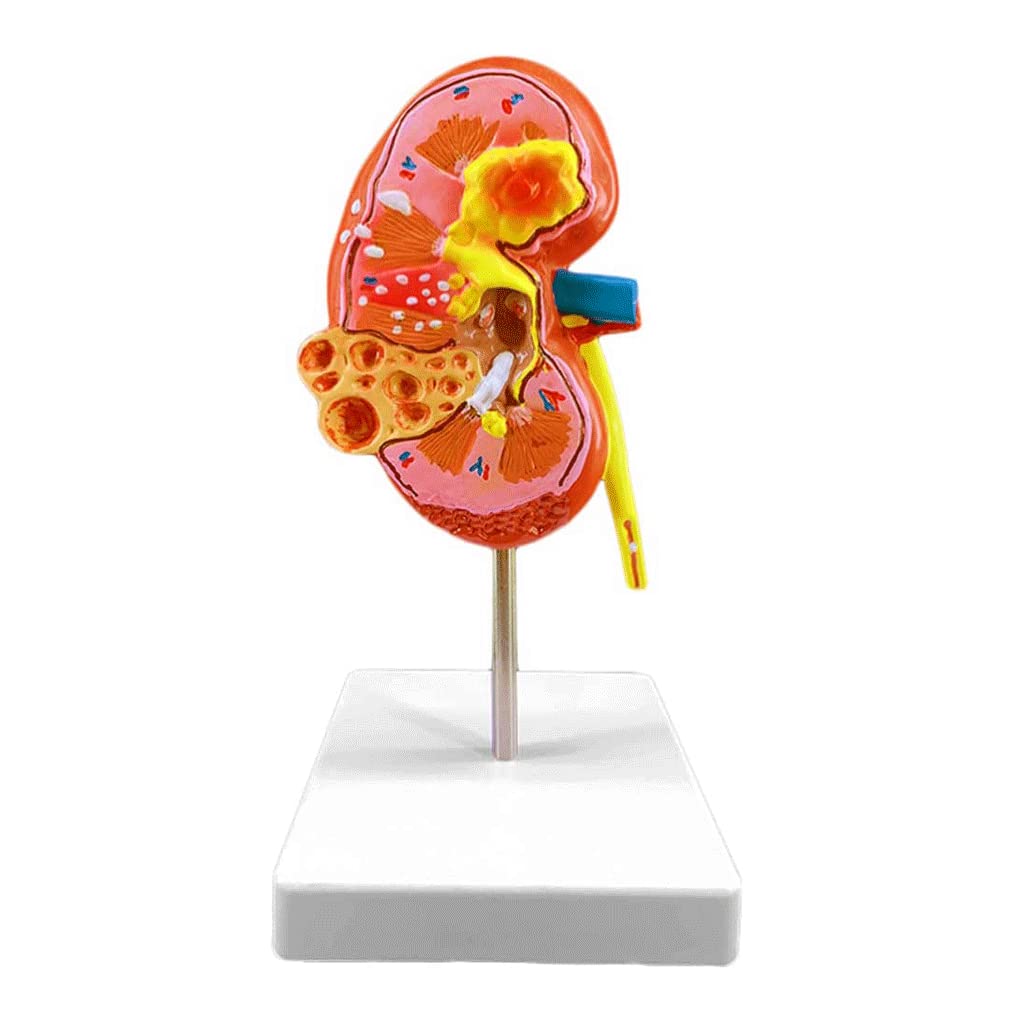 GTHTUHFD Skeleton Model Human Kidney Human Body Model Model Of Human Organs Kidney For School Medical Education Display