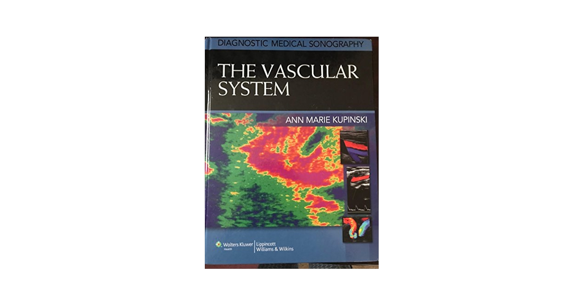 The Vascular System (Diagnostic Medical Sonography
