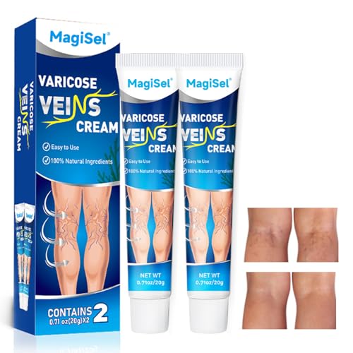 Crema varices, Crema para varices, 40g Gel frio piernas cansadas Pesadas e Hinchadas, Alivio para Varices y Arañas Vasculares, circulación sanguínea en las piernas,mejorar la inflamación de los vasos