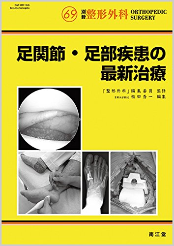 無料電子書籍 pdf 足関節・足部疾患の最新治療 (別冊整形外科) バイ