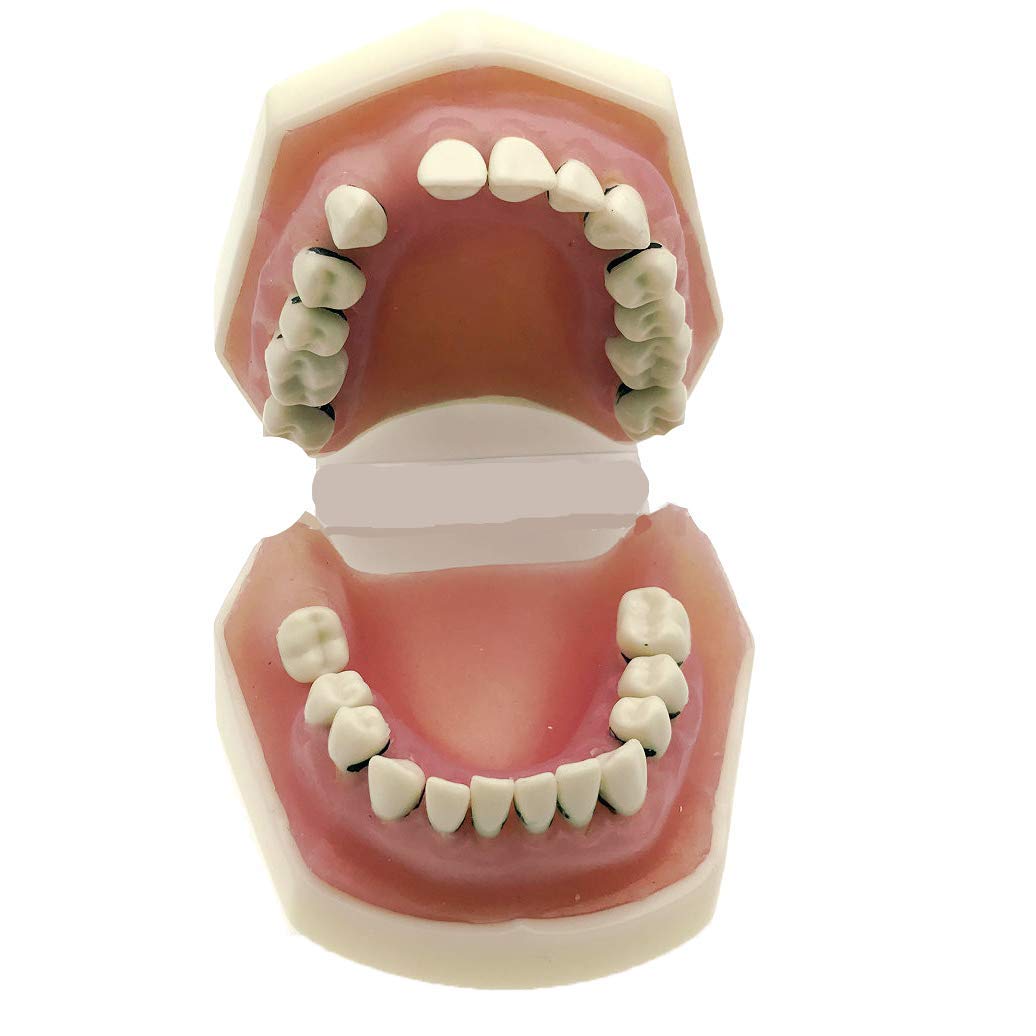 Modello Didattico di Denti Standard Ortodontici per Studenti di Odontoiatria Infantile, Modello Anatomico Dentale, Modello Dimostrativo Dentale
