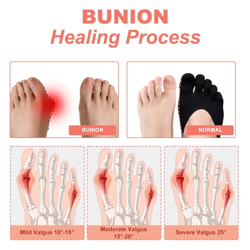 4 Pairs Orthopedic Toe Compression Socks, Toe Separator Socks for Women Soft Align Toe Socks for Bunion, Low Cut Liner Five Finger Socks for Women Size 6-9 (Black)3
