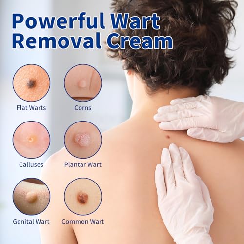 Image of Bighero 2 Pack Wart Fast Acting Gel Wart Remover Freeze Off Ointment,Wartes Cream for Genital Wartss, Warts, Plantar Warts, Common Wartes, Corn, Flat Wars NDC (84010-047-02)