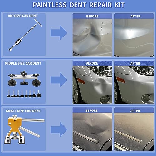ROADGIVE 97PCS Dent Repair Kit