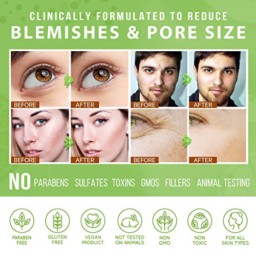 Lily Sado Tea+C Green Tea & Vitamin C Face Cleanser – Natural Vegan Antioxidant Face Wash With Aloe, Rosehip, Meadowfoam - Gentle Deep Cleansing For Acne, Blackheads, Blemishes - All Skin Types 5 Oz #TOP6