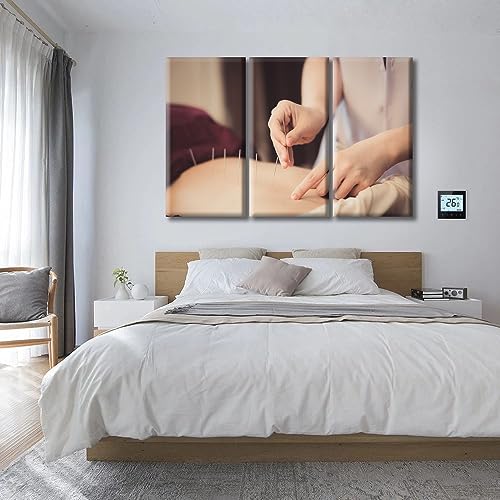 Image of TUMOVO 3 Panels Acupuncture and Moxibustion Large Wall Art Traditional Chinese Medicine Wall Art for Living Room Traditional Art Prints Giclee Print Stretched and Framed Ready to Hang (60 inch Wx40 H)