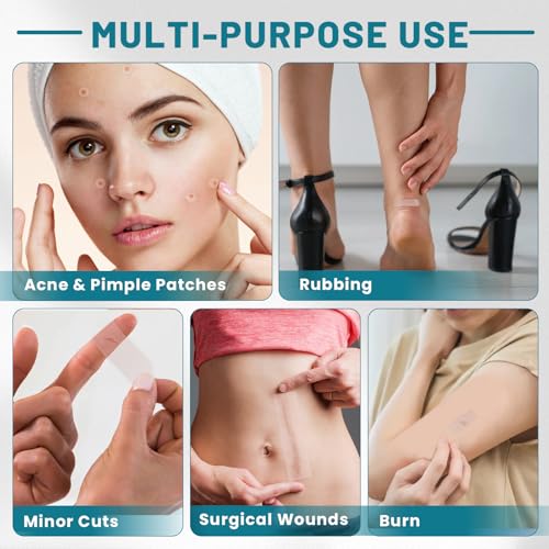 Image of Hydrocolloid Patch Large Pimple Patches for Face 3pcs 0.73in*75in Hydrocolloid Bandages Big Acne Patches Hydrocolloid Roll for Wound Care Hydrocolloid Patch Bandages Waterproof