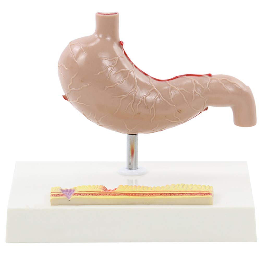 Model anatomiczny narządów ludzkich - Model anatomiczny żołądka naturalnej wielkości - Anatomiczny patologiczny żołądek Pomoce dydaktyczne i do nauki - do materiałów laboratoryjnych znakomite