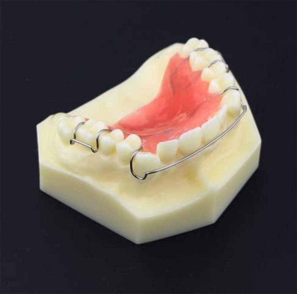 Modello di Fissaggio dentali del Fissaggio dei Denti Modello di Comunicazione Medico Attrezzi didattici per ortodontici