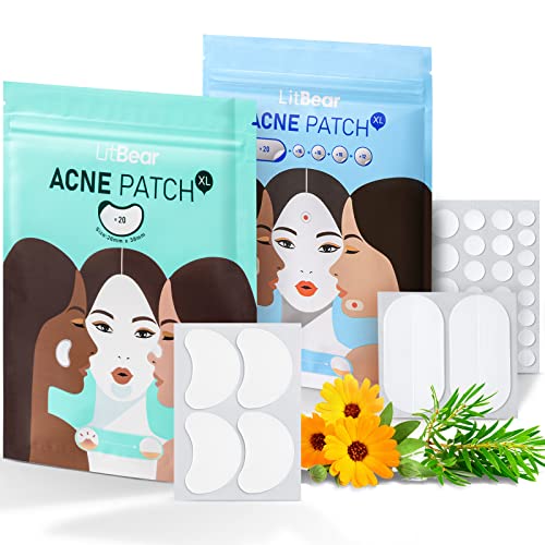 LitBear Acne Pimple Patches, 6 Sizes 100 Patches for Zit Breakouts, Large Acne Patches for Face, Chin, or Body, Acne Spot Treatment with Tea Tree & Calendula Oil, Hydrocolloid Bandages for Acne Skin