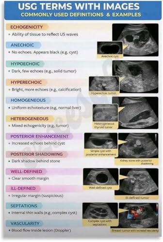 Comprehensive Ultrasound Terms Guide Educational Medical Poster with Visual Charts for Sonography Students Doctors Office or Stu