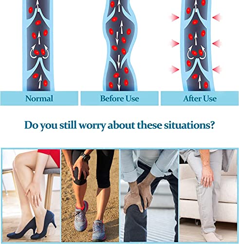 Ktinnead Compression Socks For Women And Men 20-30 Mmhg, Knee High Graduated Compression Stockings, Opaque, Open Toe, Unisex, Beige, Medium #TOP2