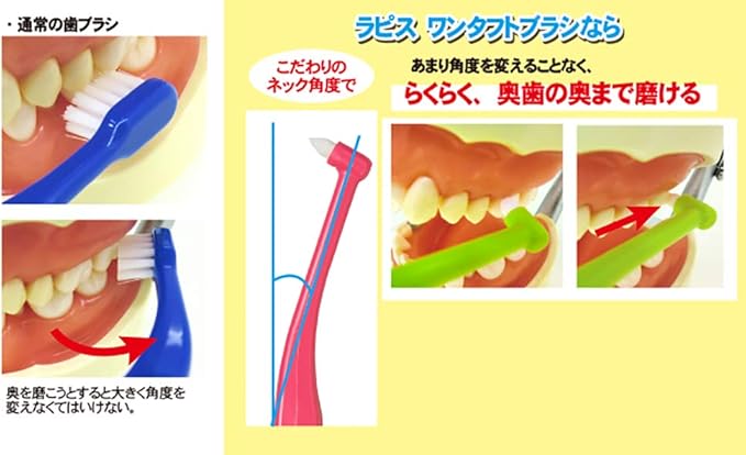 Amazon Amazon Co Jp限定 歯科用 La 001 Lapis ワンタフトブラシ ビビッド ドルツ ふつう 5本セット グッドデザイン賞受賞商品 キャップ1個付 日本製 ｌａｐｉｓ 大人用ハブラシ 通販