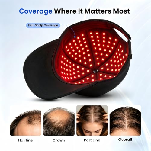 Image of CAYAMA Red Light Hair Growth Cap, 528 Emitters, Rechargeable Controller | 660nm Red + 850nm Near-Infrared Light | 3 Intensities | 10 /15 /20-Min Timer | No Wall Outlet Needed