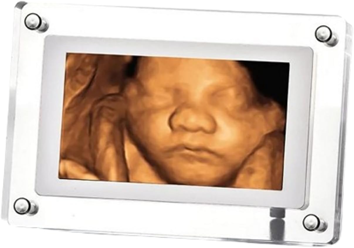 MBHB Digital Picture Frame, 7” Screen, Electronic Photo Frames for Ultrasound Replay, Re-chargeable 4GB Memory, USB Charging, Vertical/Horizontal Display, Upload Photos/Videos Easily