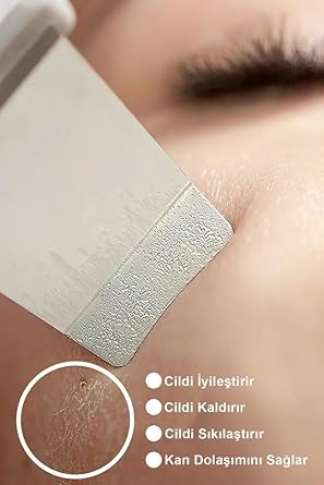 Chermic Ultrasonic Spatula Facial Blackhead Removal Tool