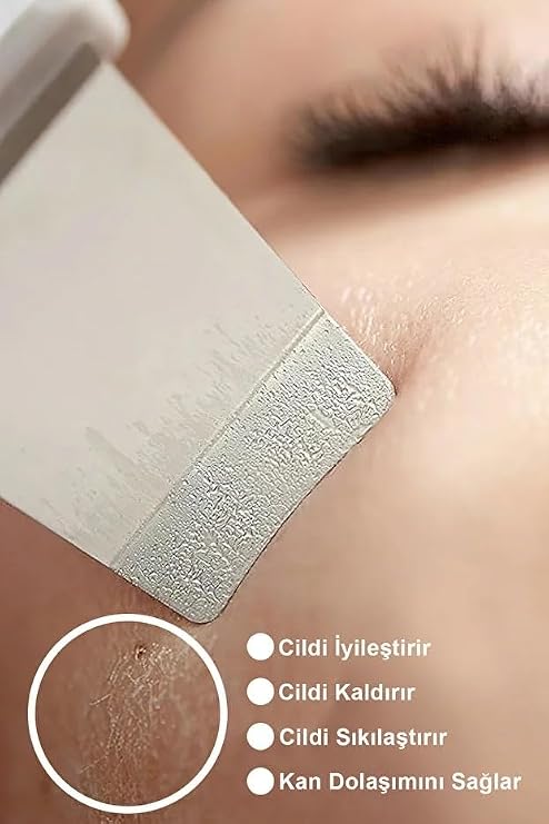 Chermic Ultrasonic Spatula Facial Blackhead Removal Tool