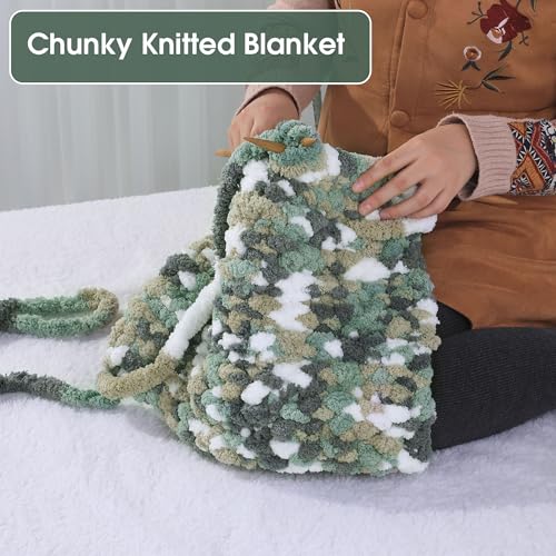 Image of Maboozo Tie Dye Chunky Yarn 8 Pack, Grey, Green, White Fluffy Jumbo Chenille, Soft Plush Bulky, Giant Thick Fuzzy Yarn for Crocheting, Hand Knitting or Arm Knitting (26 yds, 7.5 oz Each)