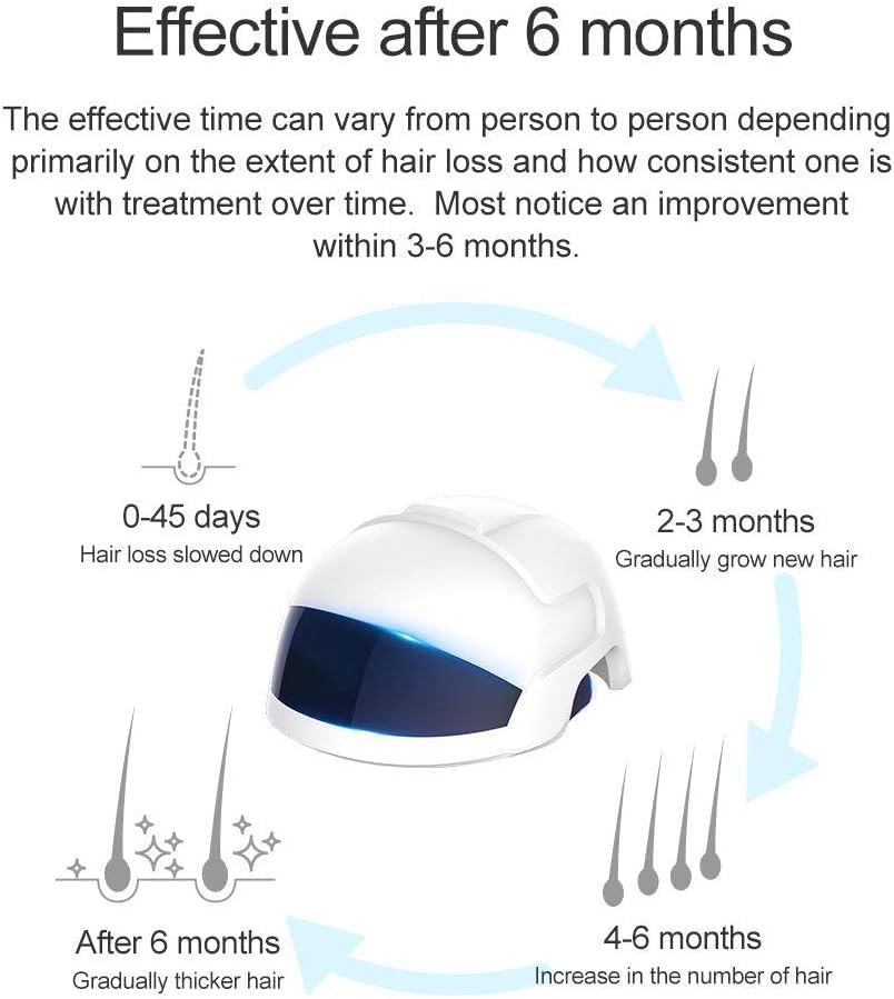 KEYOZA Anti Hair Loss Device Hair Growth Laser Helmet Hair Care Device for Men & Women Prevent Hair Loss, FDA Certified, No Side Effects - Image 3 thumbnail