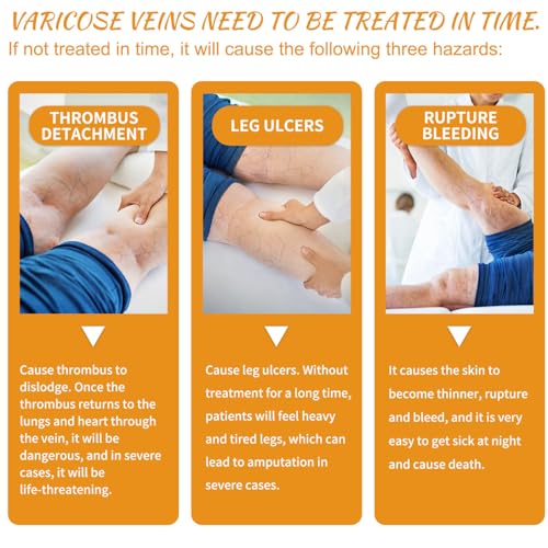 Adutry 2Pcs Varicose Veins Miracle Cream, Vitamin K Miracle Cream, Varicose Vein Cream,Suitable For Legs And Face thumb #5