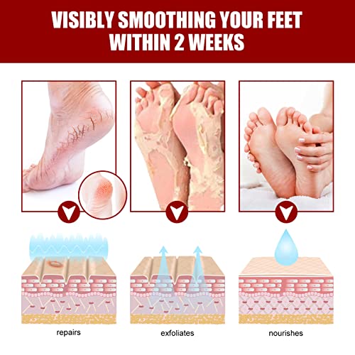 5 Pairs Exfoliating ence Foot Moisturizing Hyding Dead Skin Skin-friendly Foot Smoothing Feet