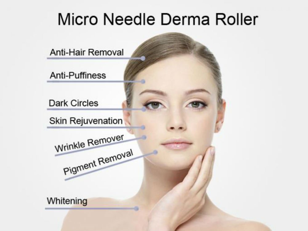 540 Ago Titanio Micro Ago Terapia Rullo Pelle Derma - 2,5 mm