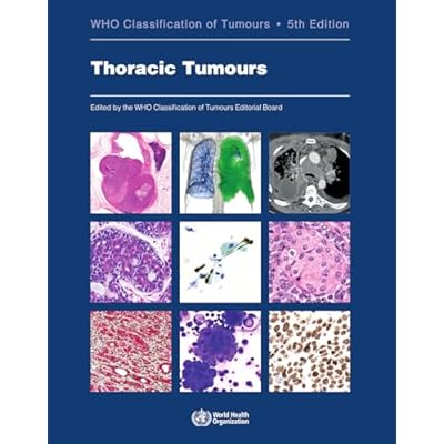 Thoracic tumours: Who Classification of Tumours: 5