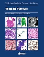 WHO Classification of Tumours (16 book series) Kindle Edition