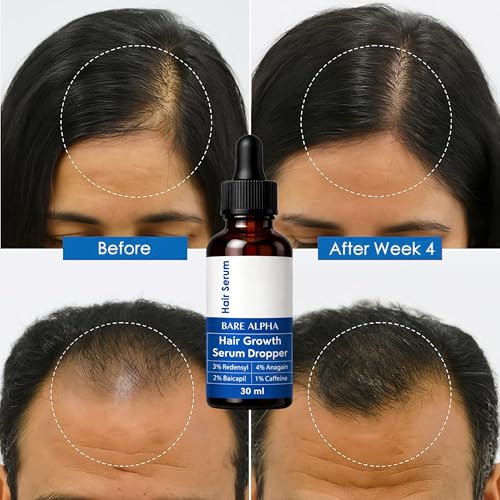 Image of Rosemary Hair Growth Serum | Redensyl, Anagain, Baicapil, Caffeine, Biotin | Enriched with Rice Water | Boosts Hair Density, Stimulates Growth & Reduces Hair Fall | For Women & Men (30ml - Rosemary)