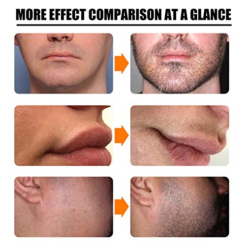 TLM Toys Bartpflege Set,Beard Growth Kit,bartwuchsmittel Männer,bart Set Bartwachstum Kit Für Männer,Beard Oil Mit Bart… - Image 5